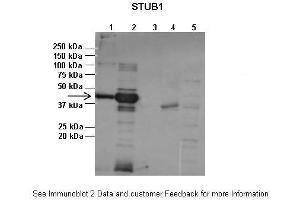 Lanes:   1:1ug insoluble STUB1 protein, 2:1ug soluble STUB1 protein, 3:1ug EPM2A protein, 4:1ug insoluble PPP1R3C protein, 5:1ug soluble PPP1R3C protein  Primary Antibody Dilution:   1:2500  Secondary Antibody:   Anti-rabbit-AP  Secondary Antibody Dilution:   1:20,000  Gene Name:   STUB1  Submitted by:   Pedro Castanheira, Biocant (STUB1 Antikörper  (N-Term))