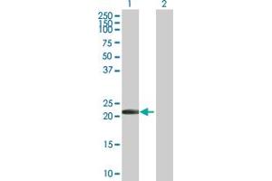 Western Blot analysis of PYCARD expression in transfected 293T cell line by PYCARD MaxPab polyclonal antibody. (PYCARD Antikörper  (AA 1-195))