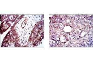 Immunohistochemistry (IHC) image for anti-Integrin beta 1 (ITGB1) antibody (ABIN1106231) (ITGB1 Antikörper)