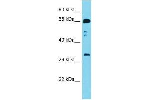 Host: Rabbit Target Name: Gnb2l1 Sample Type: Mouse Stomach lysates Antibody Dilution: 1. (GNB2L1 Antikörper  (C-Term))