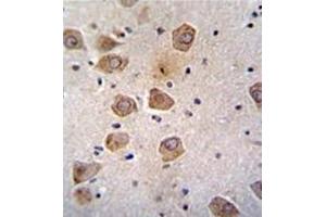 Formalin fixed, paraffin embedded human brain tissue stained with RLBP1L2 Antibody (C-term) followed by peroxidase conjugation of the secondary antibody and DAB staining. (CLVS2 Antikörper  (C-Term))