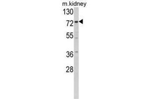Western blot analysis of Villin-1 Antibody (N-term) in mouse kidney tissue lysates (35ug/lane). (Villin 1 Antikörper  (N-Term))