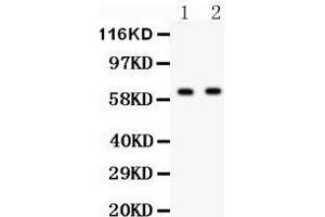 Anti- HEXB antibody, Western blotting All lanes: Anti HEXB  at 0.