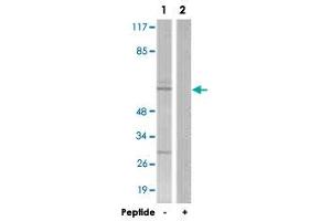 Western blot analysis of extracts from COS-7 cells, using NR4A1 polyclonal antibody . (NR4A1 Antikörper)