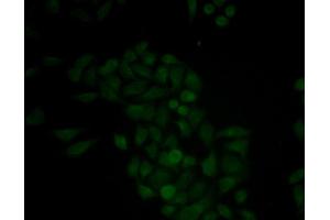 Immunofluorescence analysis of MCF-7 cell using CTSE antibody. (Cathepsin E Antikörper)