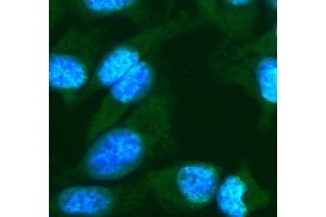 IF analysis of FGF10 using anti-FGF10 antibody (ABIN7601536).