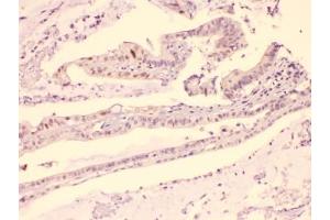 Immunohistochemistry (IHC) image for anti-Hepatoma-Derived Growth Factor (HDGF) (AA 61-97) antibody (ABIN5647572)