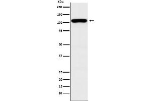 Western blot analysis of GEF H1 expression in HEK293 cell lysate. (Rekombinanter ARHGEF2 Antikörper)