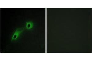 Immunofluorescence analysis of HeLa cells, using CAMK5 Antibody. (CAMKV Antikörper  (AA 211-260))
