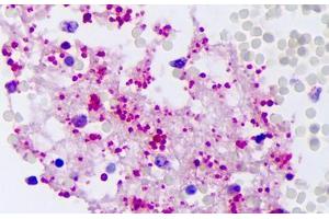Anti-PPBP antibody IHC staining of human intravascular platelets. (CXCL7 Antikörper)