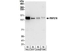 anti-Ring Finger Protein 216 (RNF216) (AA 100-150) antibody