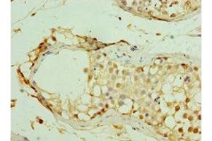 Immunohistochemistry of paraffin-embedded human testis tissue using ABIN7159289 at dilution of 1:100 (MAGEC2 Antikörper  (AA 1-150))