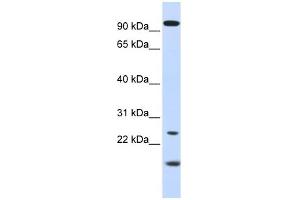 WB Suggested Anti-GUCA1A Antibody Titration: 0. (GCAP1 Antikörper  (N-Term))