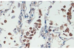 Immunohistochemistry of paraffin-embedded Human lung using APC Polyclonal Antibody at dilution of 1:200 (40x lens). (APC Antikörper)