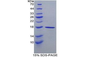 SDS-PAGE (SDS) image for Calmodulin 1 (Calm1) (AA 1-149) protein (His tag) (ABIN1981129)