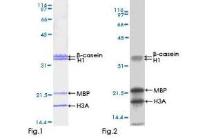 Kinase Activity Assay (KAA) image for serine/threonine Kinase 33 (STK33) (AA 1-514) protein (GST tag) (ABIN1321694)