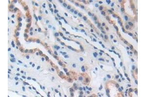 Immunohistochemistry (IHC) image for anti-CD276 (CD276) (AA 47-219) antibody (ABIN7432586)