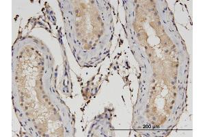 Immunostaining (ISt) image for anti-Chromosome 1open Reading Frame 89 (C1orf89) (AA 1-258) antibody (ABIN528942)