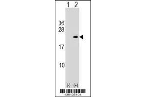 Western blot analysis of PLA2G12A using rabbit polyclonal PLA2G12A Antibody using 293 cell lysates (2 ug/lane) either nontransfected (Lane 1) or transiently transfected (Lane 2) with the PLA2G12A gene.