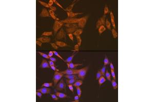 Immunofluorescence analysis of NIH-3T3 cells using USP9X Rabbit mAb (ABIN7271169) at dilution of 1:100 (40x lens). (USP9X Antikörper)