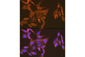 Immunofluorescence analysis of NIH-3T3 cells using USP9X Rabbit mAb (ABIN7271169) at dilution of 1:100 (40x lens). (USP9X Antikörper)