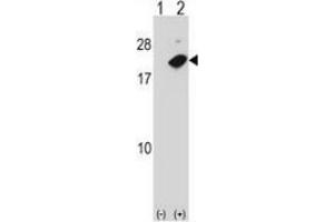 Western blot analysis of NUDT2 (arrow) using NUDT2 / APAH1 Antibody : 293 cell lysates (2 ug/lane) either nontransfected (Lane 1) or transiently transfected (Lane 2) with the NUDT2 gene. (NUDT2 Antikörper  (Middle Region))