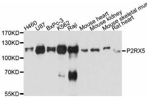 Western blot analysis of extracts of various cell lines, using P2RX5 antibody. (P2RX5 Antikörper  (AA 341-422))