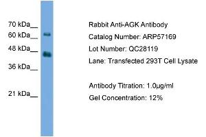 WB Suggested Anti-AGK  Antibody Titration: 0. (Acylglycerol Kinase Antikörper  (N-Term))