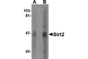 Western Blotting (WB) image for anti-Sirtuin 2 (SIRT2) (N-Term) antibody (ABIN1031568) (SIRT2 Antikörper  (N-Term))