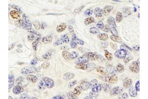 Immunohistochemistry (IHC) image for anti-Zinc Finger Protein 592 (ZNF592) (AA 950-1000) antibody (ABIN7454409)