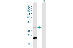 Western Blot analysis of C18orf55 expression in transfected 293T cell line ( H00029090-T01 ) by C18orf55 MaxPab polyclonal antibody. (TIMM21 Antikörper  (AA 1-248))