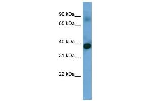 WB Suggested Anti-SFXN4 Antibody Titration: 0. (Sideroflexin 4 Antikörper  (N-Term))
