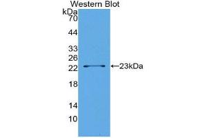 Western Blotting (WB) image for anti-Lipolysis Stimulated Lipoprotein Receptor (LSR) (AA 335-589) antibody (ABIN1176166) (LSR Antikörper  (AA 335-589))