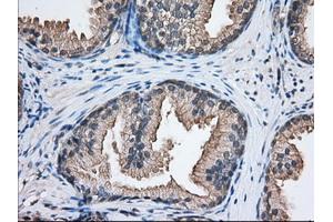 Immunohistochemical staining of paraffin-embedded Human liver tissue using anti-NXNL2 mouse monoclonal antibody. (NXNL2 Antikörper)