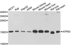 Western blot analysis of extracts of various cell lines, using ATP5D antibody. (ATP5F1D Antikörper  (AA 1-168))