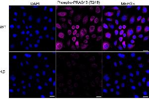 Immunocytochemical staining of HeLa cells using Phospho-PRAS40 (T246) antibody (ABIN7797545), 1:1,000), Top panel: wild-type (WT), Bottom panal: Phospho-PRAS40 (T246) shRNA knockdown (KD). (Rekombinanter PRAS40 Antikörper  (pThr246))