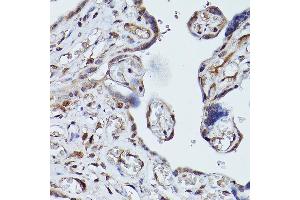 Immunohistochemistry of paraffin-embedded human placenta using PLK1 Rabbit pAb (ABIN3023351, ABIN3023352, ABIN3023353 and ABIN6219645) at dilution of 1:100 (40x lens). (PLK1 Antikörper  (AA 304-603))