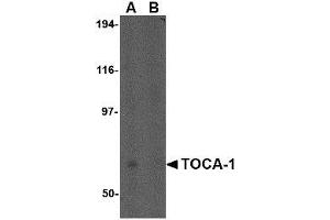 Image no. 1 for anti-Formin Binding Protein 1-Like (FNBP1L) (N-Term) antibody (ABIN1494383) (FNBP1L Antikörper  (N-Term))