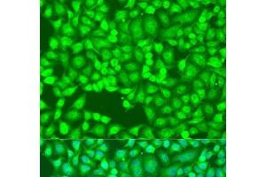 Immunofluorescence analysis of U2OS cells using FLT4 Polyclonal Antibody at dilution of 1:100. (FLT4 Antikörper)