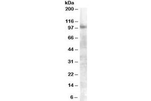 Western blot testing of A549 lysate with FGFR2 antibody at 0. (FGFR2 Antikörper)