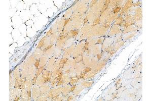 ABIN7093174 and ABIN7101256 at 1/100 staining Rat skin tissue by IHC-P. (C9 Antikörper)