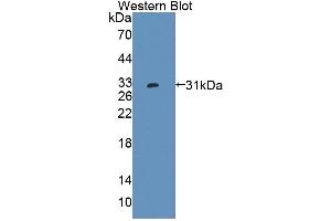 Detection of Recombinant PTPRK, Human using Polyclonal Antibody to Protein Tyrosine Phosphatase Receptor Type K (PTPRK) (PTPRK Antikörper  (AA 1185-1440))