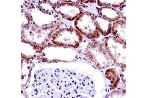 CD70 antibody immunohistochemistry analysis in formalin fixed and paraffin embedded human kidney tissue. (CD70 Antikörper  (AA 72-101))