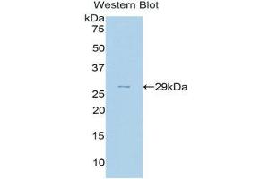 Western Blotting (WB) image for anti-Complement Factor H (CFH) (AA 975-1217) antibody (ABIN3208198) (Complement Factor H Antikörper  (AA 975-1217))