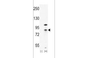 Western blot analysis of CTNB1 (arrow) using rabbit polyclonal CTNB1 Antibody (C-term) (ABIN655178 and ABIN2844795). (CTNNB1 Antikörper  (C-Term))