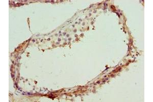 Immunohistochemistry of paraffin-embedded human testis tissue using ABIN7171810 at dilution of 1:100 (TEX35 Antikörper  (AA 1-215))