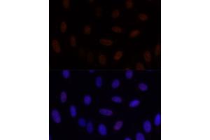 Immunofluorescence analysis of U-2 OS cells using GLI2 antibody (ABIN7267384) at dilution of 1:100. (GLI2 Antikörper)