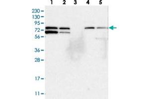 Western blot analysis of Lane 1: RT-4, Lane 2: U-251 MG, Lane 3: Human Plasma, Lane 4: Liver, Lane 5: Tonsil with SNX18 polyclonal antibody  at 1:250-1:500 dilution. (SNX18 Antikörper)