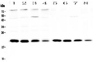 Western blot analysis of BNIP3 using anti-BNIP3 antibody .