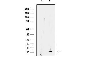 anti-Ubiquinol-Cytochrome C Reductase, Complex III Subunit VII, 9.5kDa (UQCRQ) (Internal Region) antibody